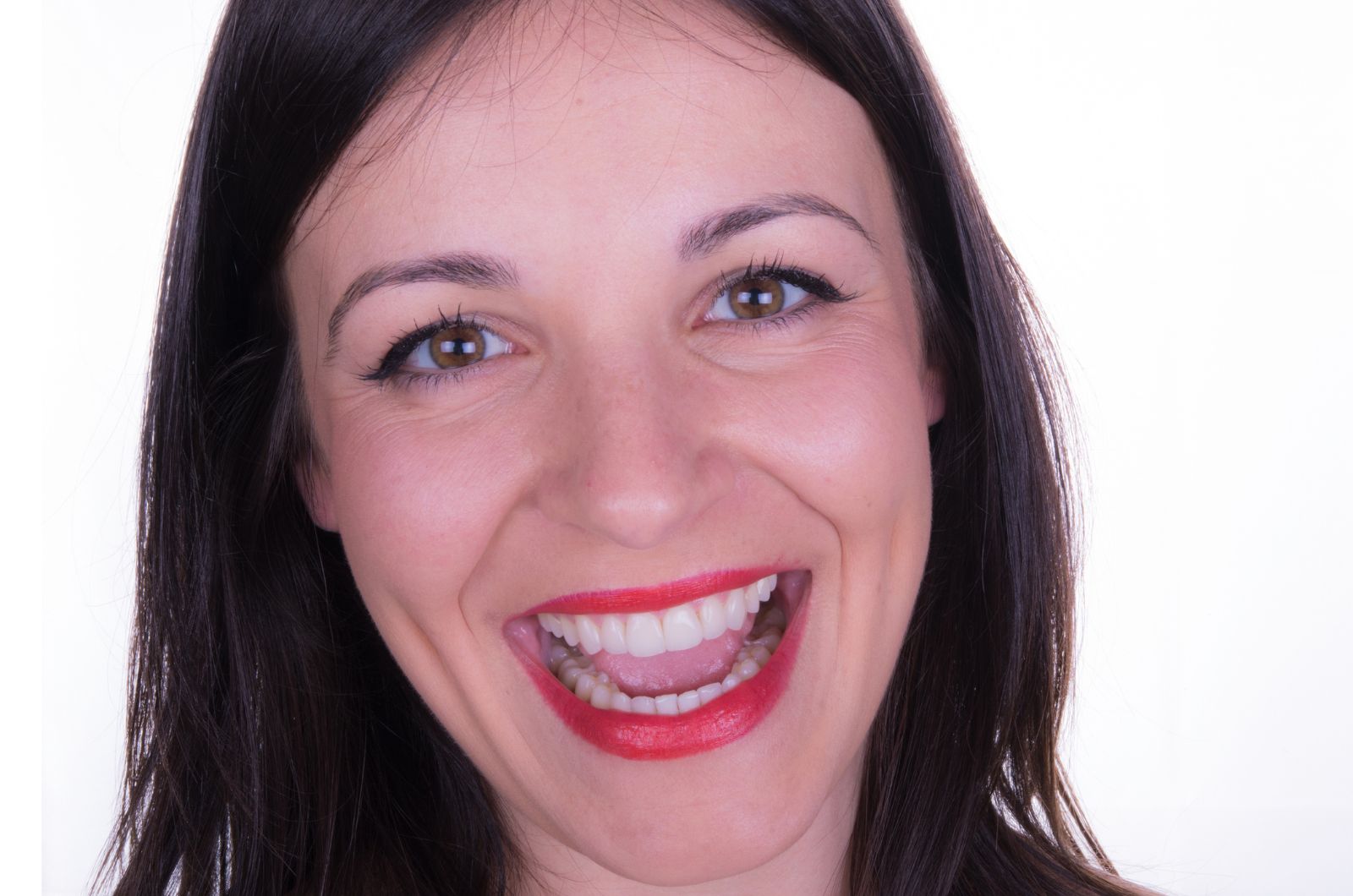 Sorriso naturale e luminoso ottenuto con faccette dentali in ceramica alla Clinica Salzano Tirone di Cuneo, realizzate con progettazione digitale e materiali di altissima qualità per un risultato estetico duraturo.