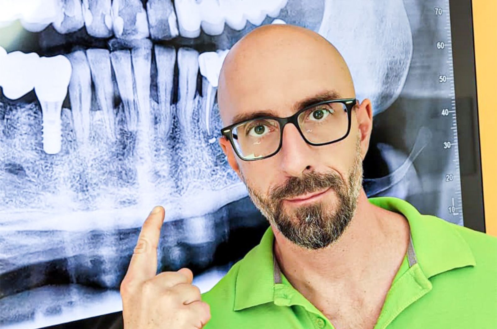 Dott. Federico Tirone che indica una radiografia di un impianto dentale